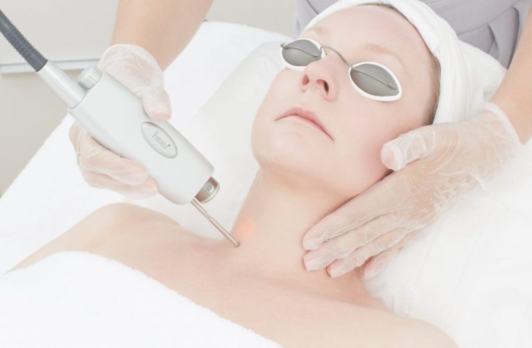 Is Laser Hair Removal Easy and Safe?